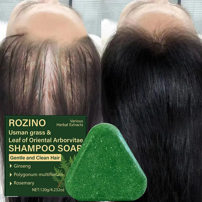 Nature Seven Green Shampoo Bar – Hair Growth & Gray Hair Reversal with Ginseng & Rosemary